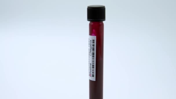 Positive Covid Test Laboratory Sample Blood Testing Diagnosis New Corona — Stock Video