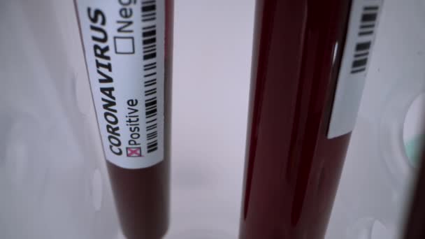 Tubo Teste Com Amostra Sangue Infectado Para Covid Novo Coronavírus — Vídeo de Stock