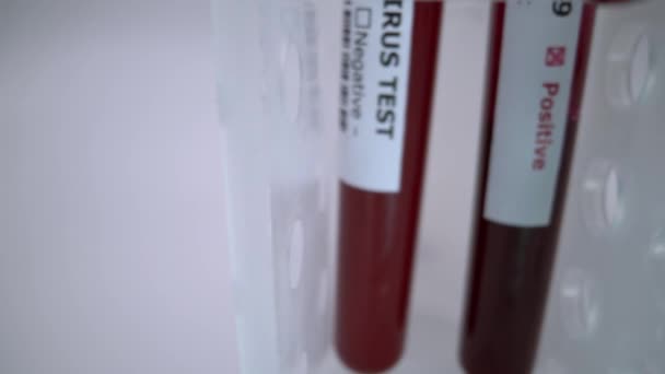 Tubo Muestra Sangre Para Prueba Corona Covid Virus Causado Una — Vídeo de stock