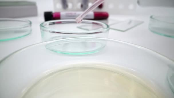 生化学検査の血液サンプルにコロナウイルス感染を追加するピペットを用いた実験室での実験医学検査 研究室でコロナウイルスの解析を行う科学者の手 — ストック動画