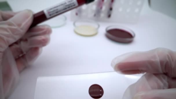 Coronavirus Testi Pozitif Kan Tahlili Çin Den Gelen Kovid Yeni — Stok video