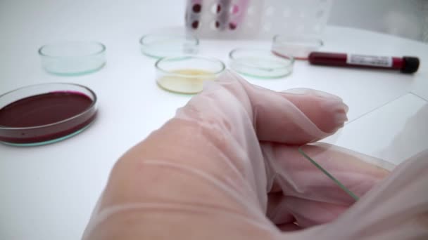 感染性コロナウイルスのための研究室テスト Covid 19パンデミックアウトブレイク防止コンセプト ウイルス学のテスト インフルエンザ感染のための科学的テスト 顕微鏡スライドダンの閉鎖 — ストック動画