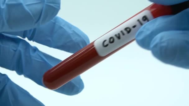 Covid 복구를 관리의 움직임 긍정적 코로나 바이러스를 검사를 시켰어요 과학자의 — 비디오