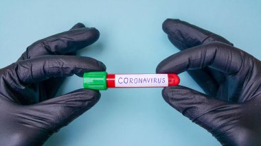 Coronavirus Covid-19 vakum tüpleri laboratuardaki kan örnekleriyle tıbbi çalışmalar için. Coronavirus Testi. Siyah lastik eldivenli bir doktor eli. Mavi arkaplanda metin için boşluk.