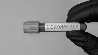 Coronavirus Covid-19 vakum tüpleri laboratuardaki kan örnekleriyle tıbbi çalışmalar için. Coronavirus Testi. Siyah lastik eldivenli bir doktor eli. Siyah beyaz foto. Metin için boşluk. 
