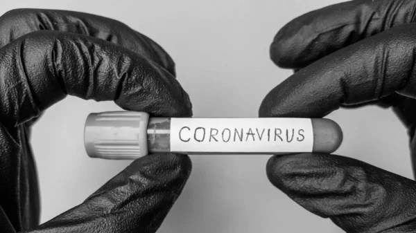 Coronavirus Covid-19 vakum tüpleri laboratuardaki kan örnekleriyle tıbbi çalışmalar için. Coronavirus Testi. Siyah lastik eldivenli bir doktor eli. Siyah beyaz foto. Metin için boşluk. 