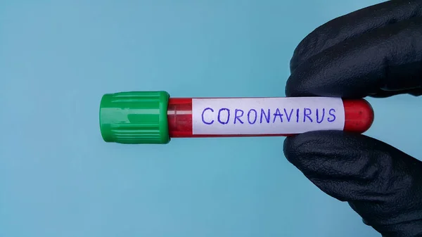 Coronavirus Covid-19 vakum tüpleri laboratuardaki kan örnekleriyle tıbbi çalışmalar için. Coronavirus Testi. Siyah lastik eldivenli bir doktor eli. Mavi arkaplanda metin için boşluk.