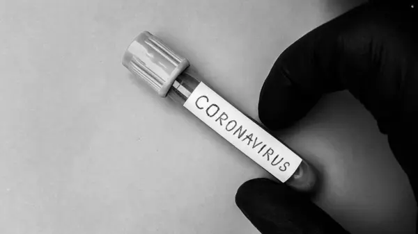 Koronavirus Covid Vakuové Trubice Pro Lékařskou Práci Krevními Vzorky Laboratoři — Stock fotografie