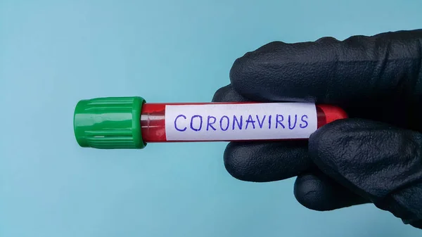 Koronavirus Covid Vakuové Trubice Pro Lékařskou Práci Krevními Vzorky Laboratoři — Stock fotografie