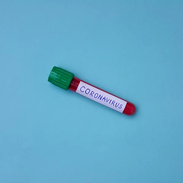 Coronavirus Covid Vákuum Csövek Orvosi Munkához Vérmintákkal Laboratóriumban Koronavírus Teszt — Stock Fotó