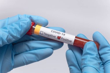 Koronavirüs için kan testi pozitif çıktı. Tıbbi müdahale, üzerinde kan olan test tüpü, lateks tıbbi eldiven. Coronavirüs salgını ve grip. 2019-ncov, covid-19, sars. Yüksek kalite fotoğraf. 