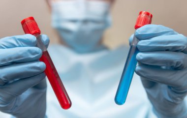 Koruyucu giysili doktor, tıbbi maske ve lateks eldivenler kan ve aşı dolu test tüpleri tutuyor. Coronavirus pozitif ve negatif kan testi. 