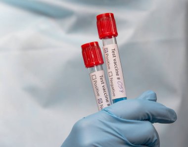 Coronavirus aşısı, pozitif ve negatif. Koruyucu giysili doktor, tıbbi maske ve lateks eldivenler aşı ile test tüpleri tutuyor.. 