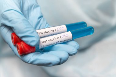 Coronavirus aşısı, pozitif ve negatif. Koruyucu giysili doktor, tıbbi maske ve lateks eldivenler aşı ile test tüpleri tutuyor.. 