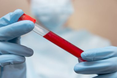 Coronavirus kan testi. Koruyucu giysili doktor, tıbbi maske ve lateks eldivenler içinde kan olan bir tüp tutuyor.. 