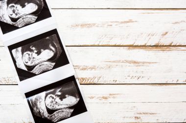 Ultrason ve ahşap arka plan üzerinde emzik