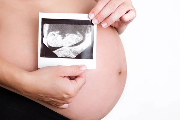Mulher grávida segurando ultra-sonografia isolada em fundo branco — Fotografia de Stock