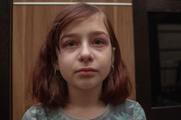 Retrato de una niña llorando con lágrimas rodando por sus mejillas. Una chica de 9 años con un corte de pelo de caret está molesto — Foto de Stock