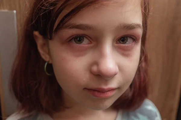 Retrato de una niña llorando con lágrimas rodando por sus mejillas. Una chica de 9 años con un corte de pelo de caret está molesto —  Fotos de Stock