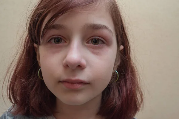 Retrato de una niña llorando con lágrimas rodando por sus mejillas. Una chica de 9 años con un corte de pelo de caret está molesto —  Fotos de Stock