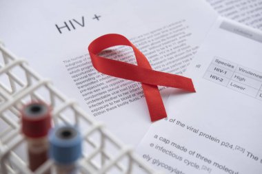 HIV pozitif örneği ve hasta grafiğini kapat.