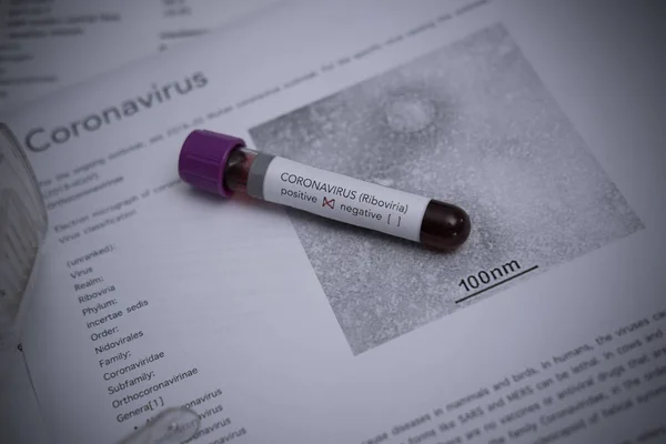 Sampel Darah Dengan Coronavirus Berbaring Atas Kertas Medis — Stok Foto