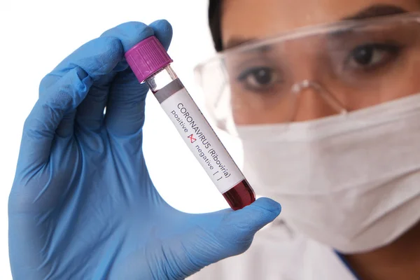 Laboratorní Diagnostik Brýlích Rukavicích Vzorkem Krve Koronavirová Epidemie — Stock fotografie