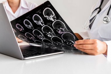 Kadın doktorlar, tedavi uzmanları, röntgenden sonra hastalarla görüşmek için randevu alın, tavsiye verin, tıbbi bilgileri açıklayın ve hastalığı teşhis edin. Tedavi ve sağlık kavramı