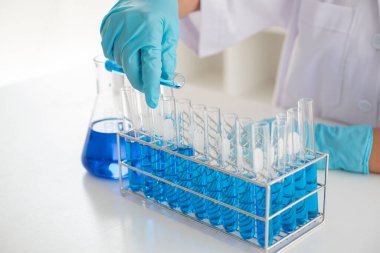 Tıp bilimcileri kimyasal laboratuarlardaki viral verileri analiz etmek için tüp bebek kimyasalları üzerinde deney yaptılar. Bilimsel araştırma kavramları.