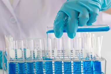 Tıp bilimcileri kimyasal laboratuarlardaki viral verileri analiz etmek için tüp bebek kimyasalları üzerinde deney yaptılar. Bilimsel araştırma kavramları.