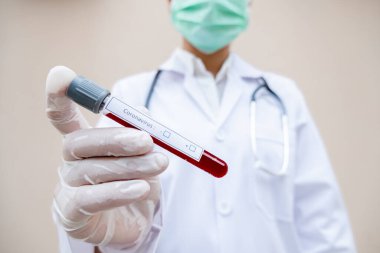Profesyonel doktorlar, koroner virüs enfeksiyonları analizi ve bulaşıcı hastalıkların, tıbbi konseptlerin ve sağlık hizmetlerinin örneklerinin teşhisi için kan testlerinden COVID-19 testleri gerçekleştirirler..