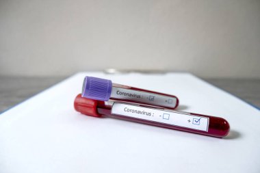 Profesyonel doktorlar, koroner virüs enfeksiyonları analizi ve bulaşıcı hastalıklar, tıbbi kavramlar ve sağlık hizmetleri örneklerinin teşhisi için kan testlerinden COVID-19 testleri gerçekleştirirler..