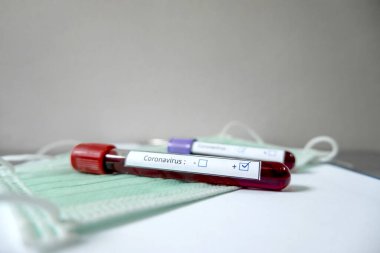 Profesyonel doktorlar, koroner virüs enfeksiyonları analizi ve bulaşıcı hastalıklar, tıbbi kavramlar ve sağlık hizmetleri örneklerinin teşhisi için kan testlerinden COVID-19 testleri gerçekleştirirler..