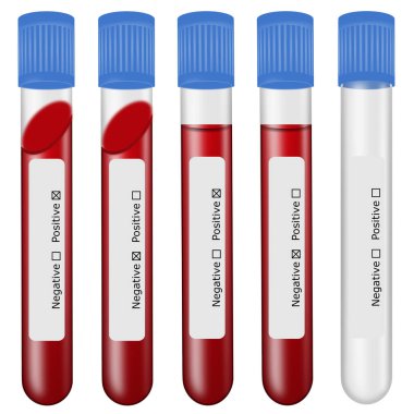 İzole kan testleri. Etiketli dolu ve boş test tüpleri. pozitif ve negatif testler
