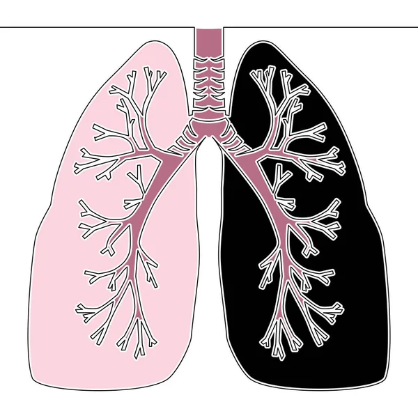 Flat Colorful Continuous Drawing Line Art Sick Lungs Icon Vector — Stock Vector