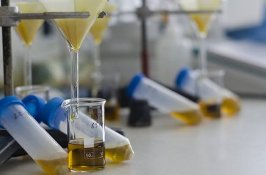 İdrar örneği-serisi degrade boyama sarı ile tüplerin