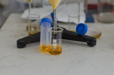 İdrar örneği-serisi degrade boyama sarı ile tüplerin