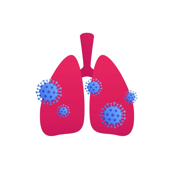 Коронавірус Вірус Легеневої Інфекції Векторна Плоска Ілюстрація Символ Блакитної Хвороби — стоковий вектор