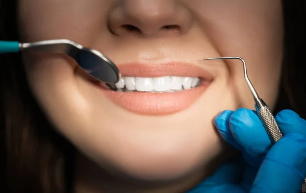 Uśmiechnięta piękna brunetka pacjentka badana przez dentystę w niebieskich rękawiczkach z użyciem lusterka dentystycznego i skalera podczas wizyty w klinice stomatologicznej, zbliżenie, koncepcja opieki zdrowotnej — Zdjęcie stockowe