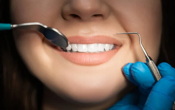 Sonriente hermosa mujer morena feliz paciente examinado por el dentista en guantes azules utilizando espejo dental y escalador durante la visita a la clínica dental, de cerca, concepto de salud — Foto de Stock