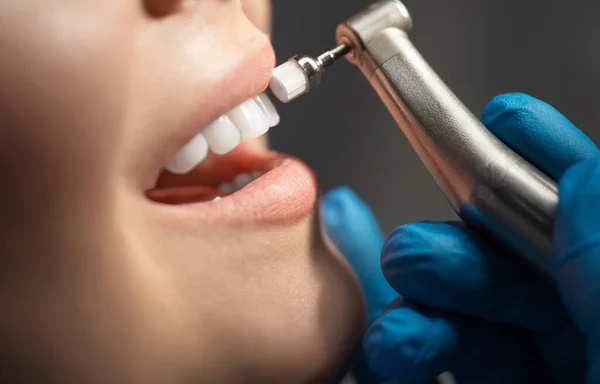 Proces používání zubního kartáče jako fáze profesionálního čištění zubů postup v klinice zblízka, Krásná žena zdravý úsměv zblízka, koncept zdravotní péče — Stock fotografie