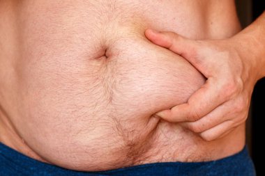 Bir adam karnını eliyle tutar ve şişmanlığını gösterir..