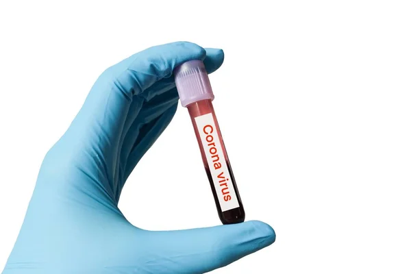 Concepção de fundo de surtos de Coronavirus 2019 — Fotografia de Stock