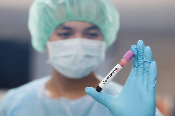 Krevní test koronaviru v nemocniční laboratoři — Stock fotografie