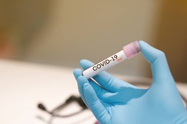 Covid-19 laboratuvar kan testi, koronavirüs geçmişi konsepti. 