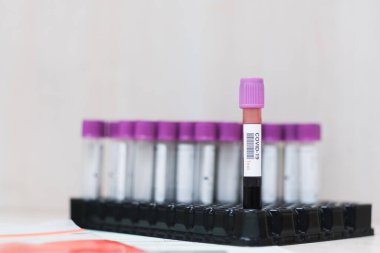 Hastane laboratuvarında Covid-19 kan testi. 