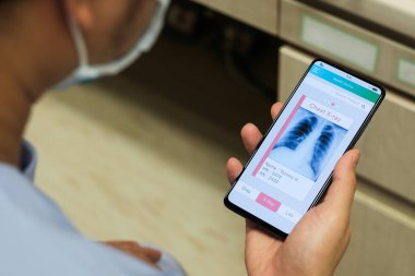 Akıllı telefon uygulamasında doktor görüşü göğüs röntgeni 