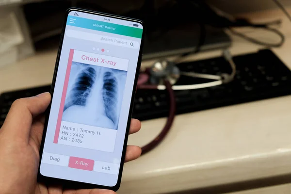 Médico Radiografía Tórax Aplicación Para Teléfonos Inteligentes —  Fotos de Stock