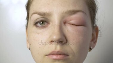 Göz üzerinde anti olan kadın