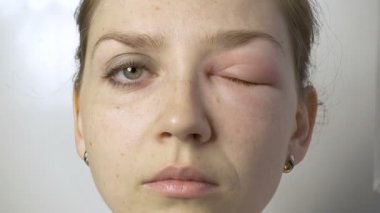 Kadın alerjisi bakılması, aşağı, sol, sağ